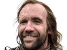 sandor-clegane-limier-chien-cicatrice-brule-game-thrones-agot-serie-rory-mccann-homme-yeux-marrons-cheveux-bruns