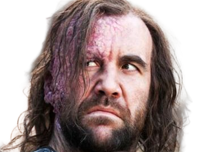 sandor clegane limier chien cicatrice brule game thrones agot serie rory mccann homme yeux-marrons cheveux-bruns