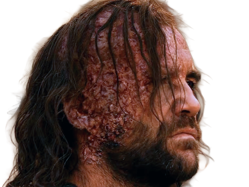 sandor clegane limier chien cicatrice brule game thrones agot serie rory mccann homme yeux-marrons cheveux-bruns