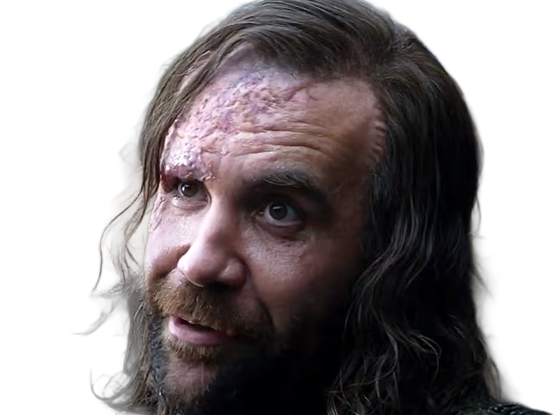sandor clegane limier chien cicatrice brule game thrones agot serie rory mccann homme yeux-marrons cheveux-bruns