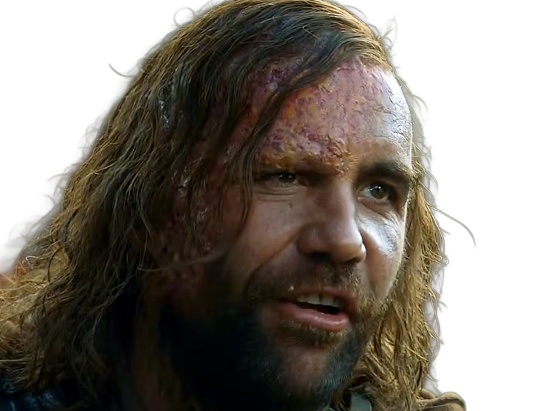 sandor clegane limier chien cicatrice brule game thrones agot serie rory mccann homme yeux-marrons cheveux-bruns