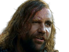 sandor-clegane-limier-chien-cicatrice-brule-game-thrones-agot-serie-rory-mccann-homme-yeux-marrons-cheveux-bruns