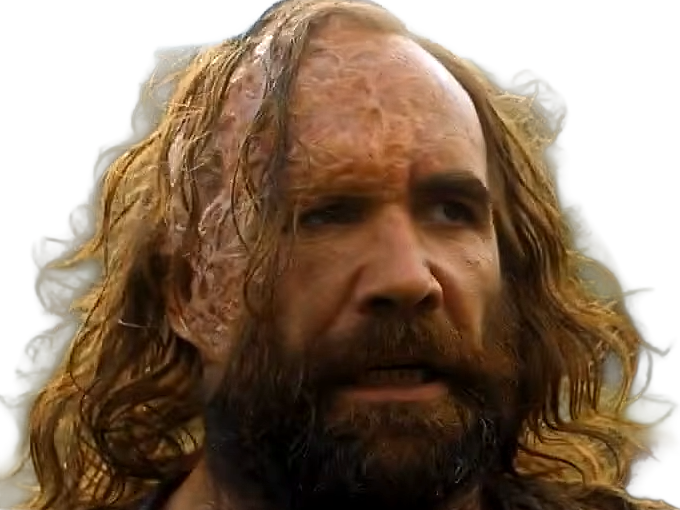 sandor clegane limier chien cicatrice brule game thrones agot serie rory mccann homme yeux-marrons cheveux-bruns