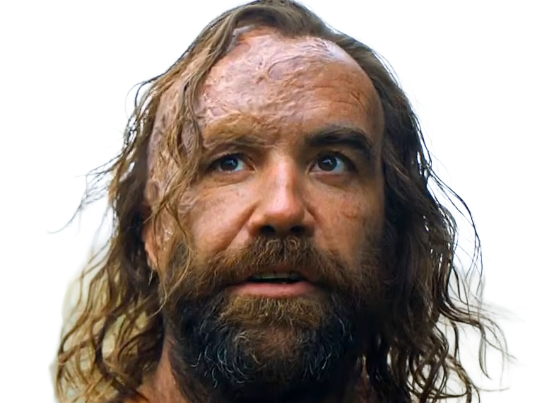 sandor clegane limier chien cicatrice brule game thrones agot serie rory mccann homme yeux-marrons cheveux-bruns
