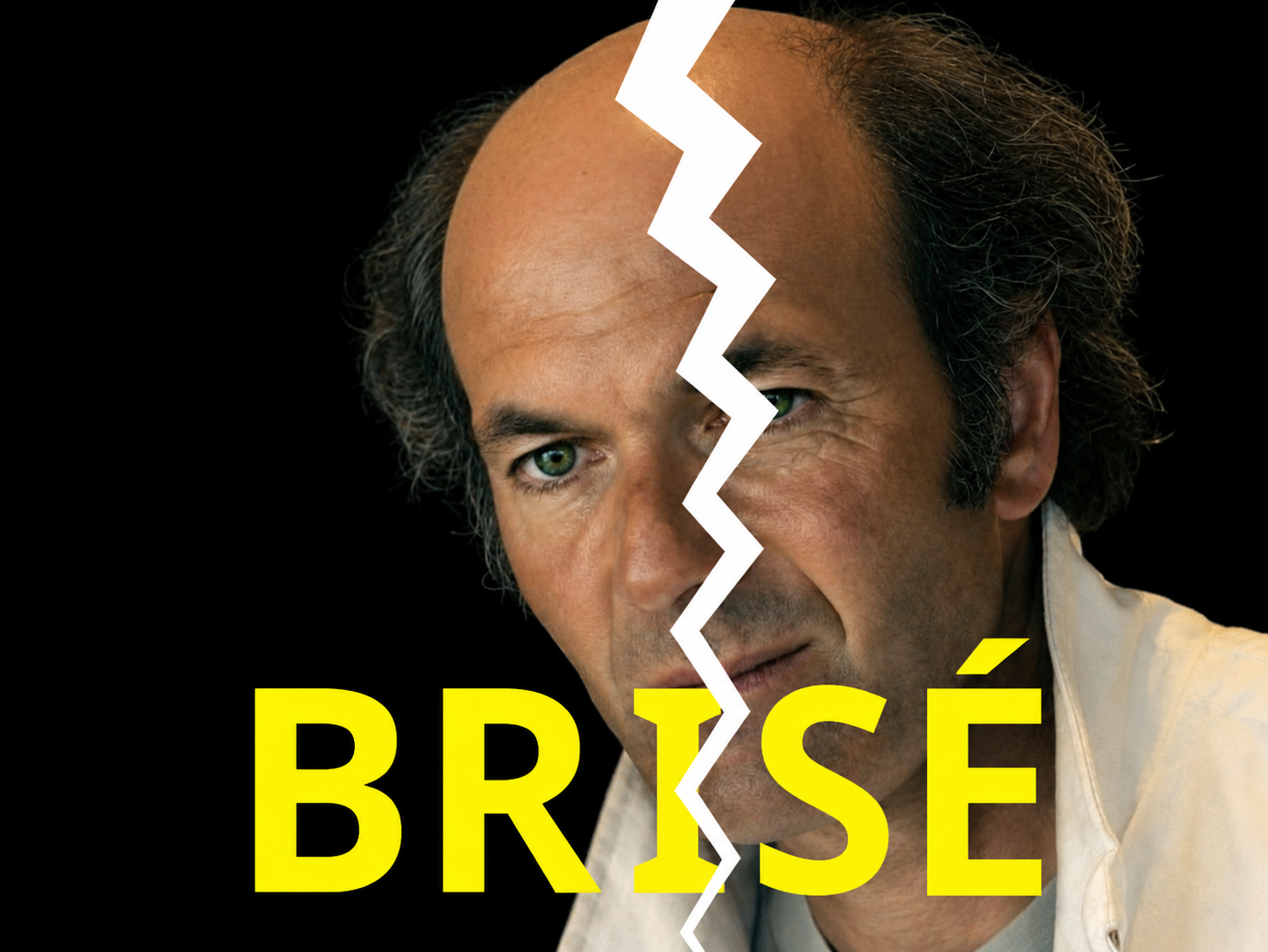 zidane brise calvitie