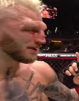 hooker-ufc-mma-arman-blessure-visage