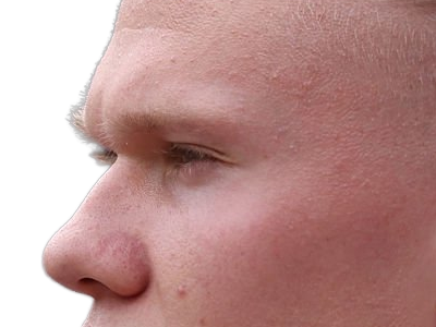 Sticker erling haaland haland braut cyborg homme sportif footballeur norvegien anglais blond yeux bleus vingtaine vingtenaire par Dark-63