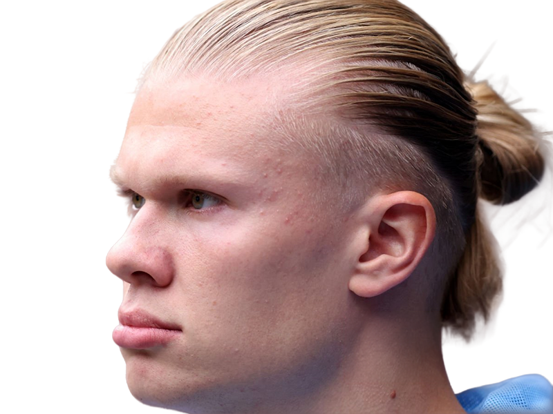 Sticker erling haaland haland braut cyborg homme sportif footballeur norvegien anglais blond yeux bleus vingtaine vingtenaire par Dark-63