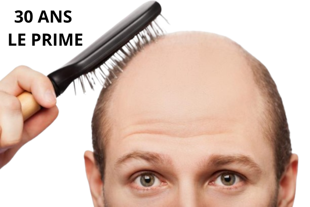 Sticker calvitie chad bg chauve cheveux prime goodwine homme par un_forum_lambda