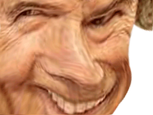 deguelasse grimace deforme chirurgie moche creepy horrible esthetique celestin botox alerte laid risitas ethanol