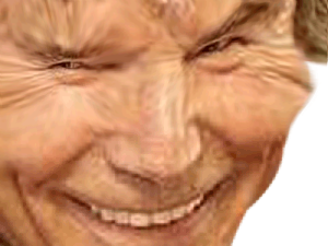 horrible chirurgie botox alerte grimace creepy risitas ethanol celestin deguelasse deforme moche esthetique laid