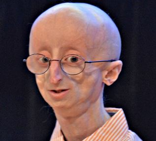 risitas progeria harry potter