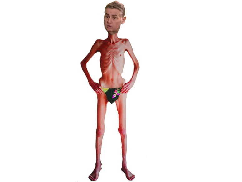 maigre anorexique pierre menes regime camp auschwitz squelette phasme