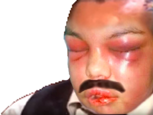 eussou risitas bougnadere issou