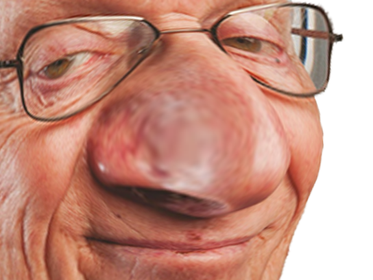 juif deformation larry chance gros nose chanceux nez lucky deforme