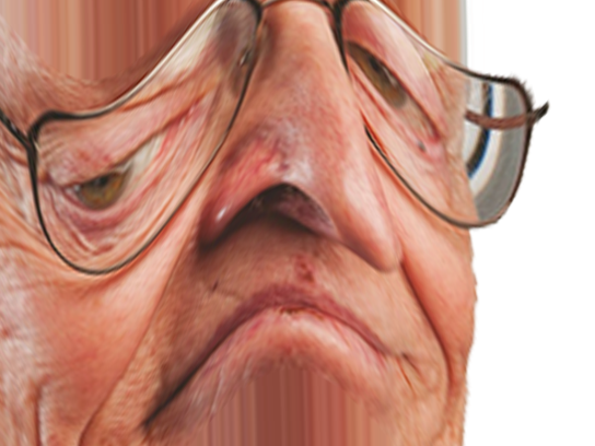 nose deformation triste nez chanceux larry gros lucky chance deforme juif