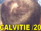 calvitie-sur-20-immondice-chauve-other-aya