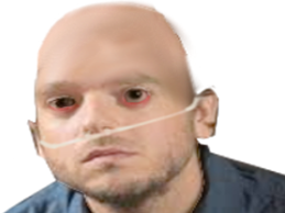 greg pale other cancer malade guillotin blanc