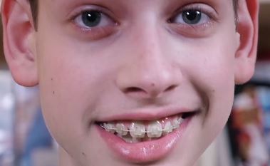 bg gamin risitas con tete zoom