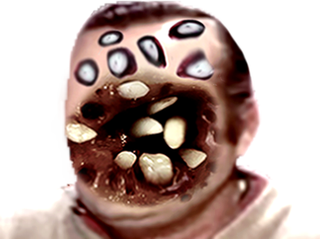 difforme abomination tumeur issou gange aya immondice risitas trypophobia