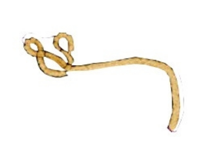 afrique malade virus ebola noir