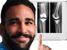 other-adil-ligaments-rami