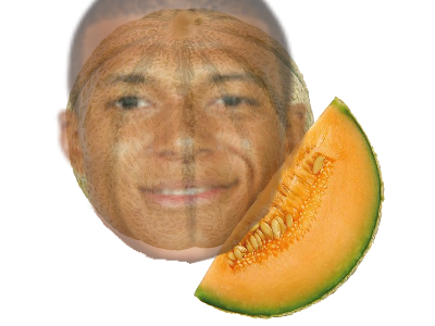 on melon mboulard head mbappe shoulders