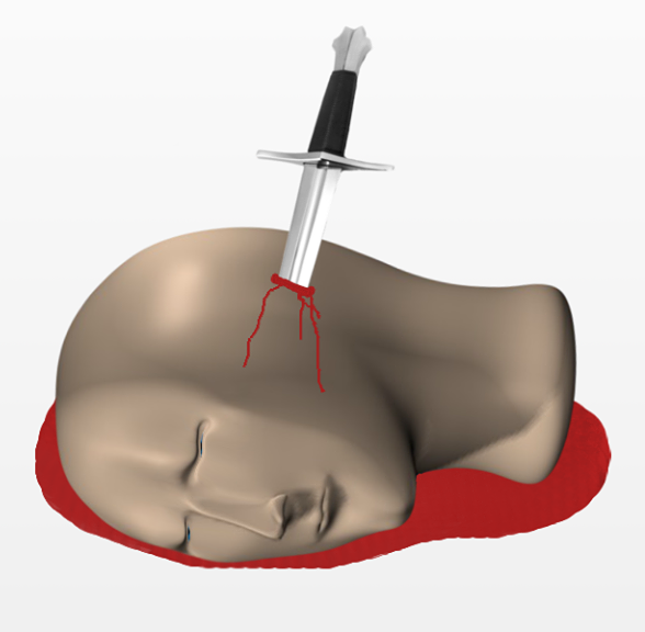 mort loubard surreal risitas couteau