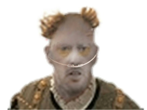 cancer godefroy jvc tube calvitie